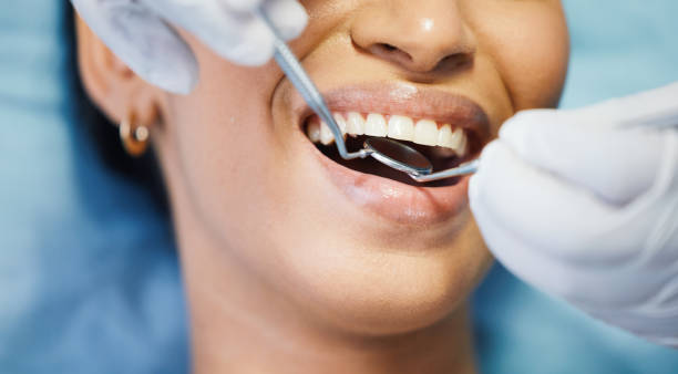 Best Emergency Dental Care for Broken or Chipped Teeth in St James, NY